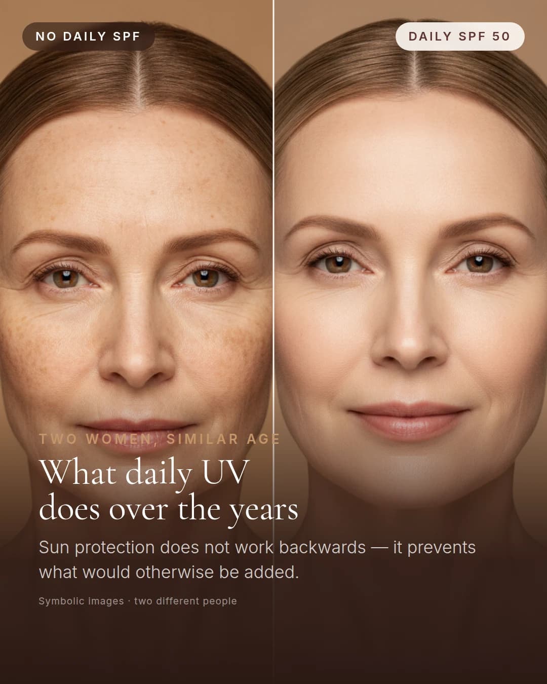 Skin without daily sun protection compared to skin with daily SPF 50 — symbolic images, two different people